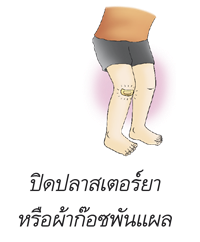 ปิดปาสเตอร์